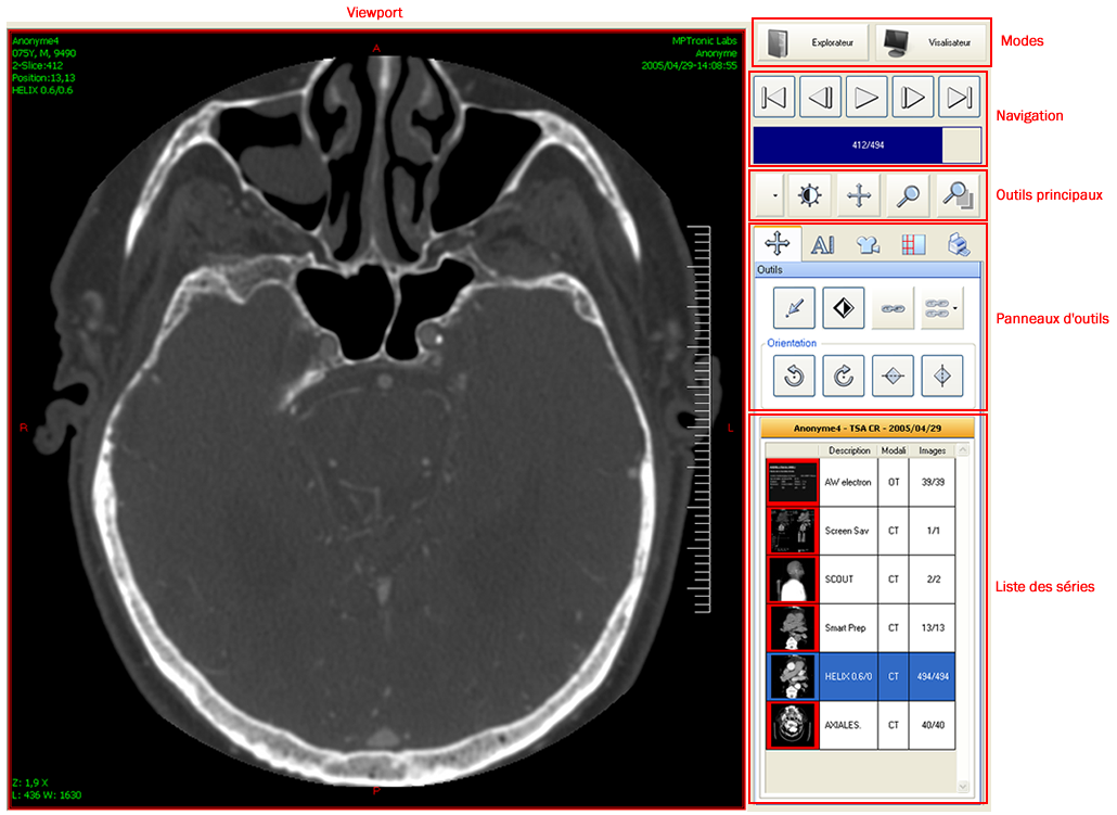 Dicom sender software download